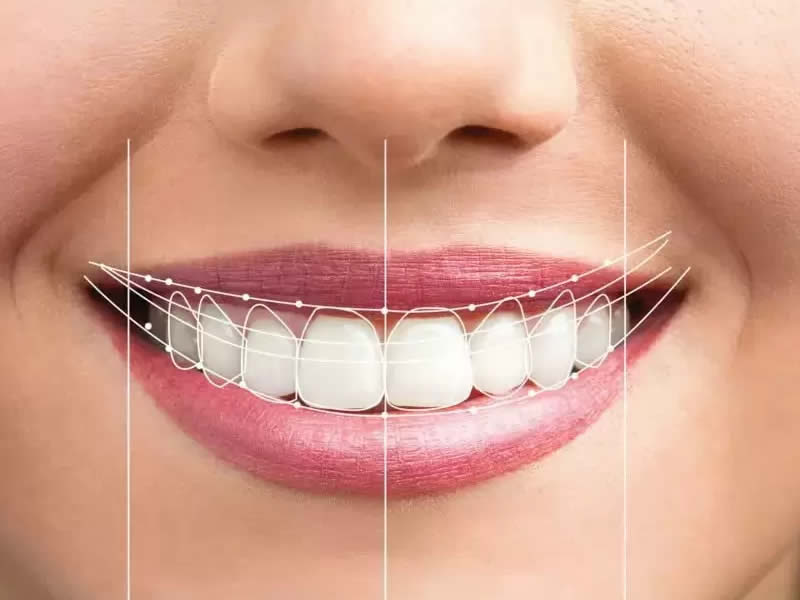 Estetik Diş Hekimliği